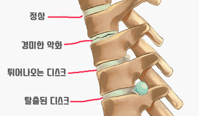 디스크 상태