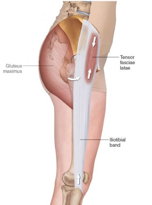 대퇴근막장근의 해부학 그림으로 골반의 측면을 나타내고 있는 그림