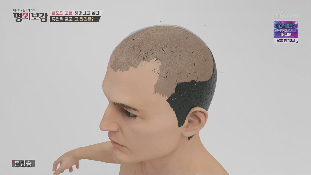 메디컬다큐 명의보감.E03.230527p.H264-F1RST.mp4_20230529_173118.002.jpg