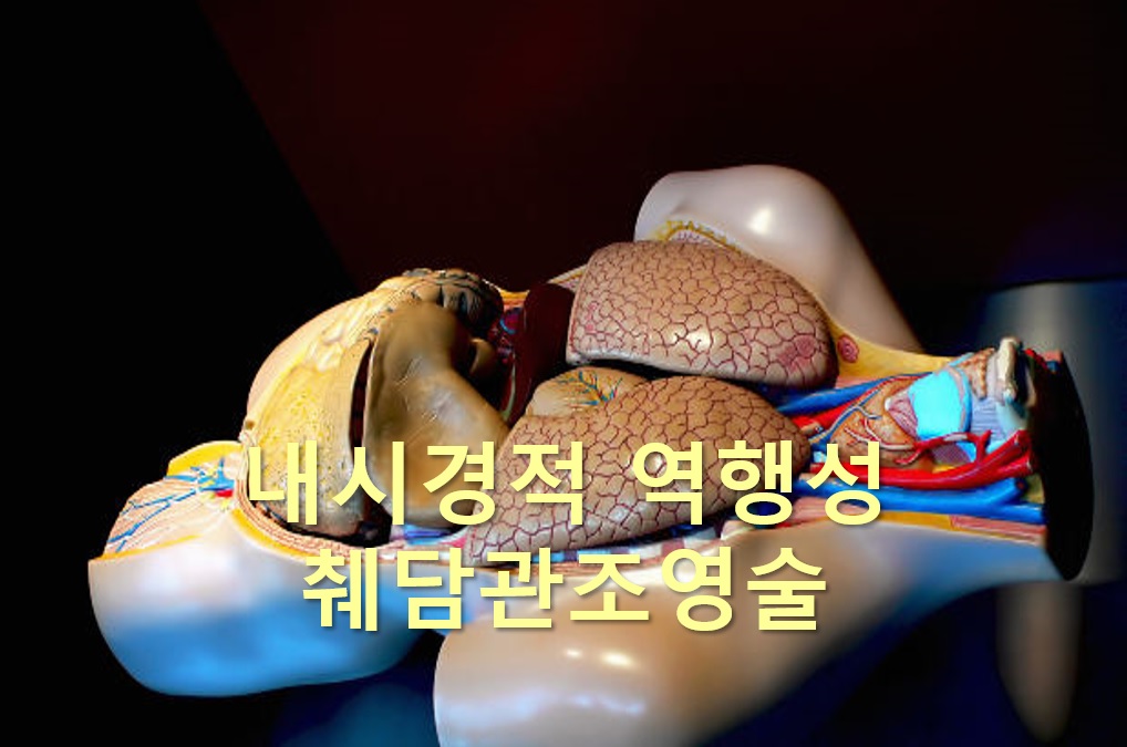  내시경적 역행성 췌담관조영술