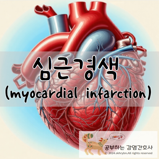 심근경색 (myocardial infarction)