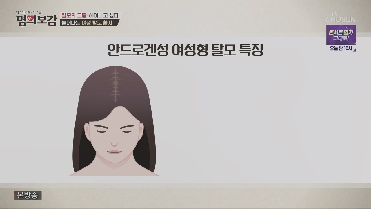 메디컬다큐 명의보감.E03.230527p.H264-F1RST.mp4_20230529_173119.437.jpg