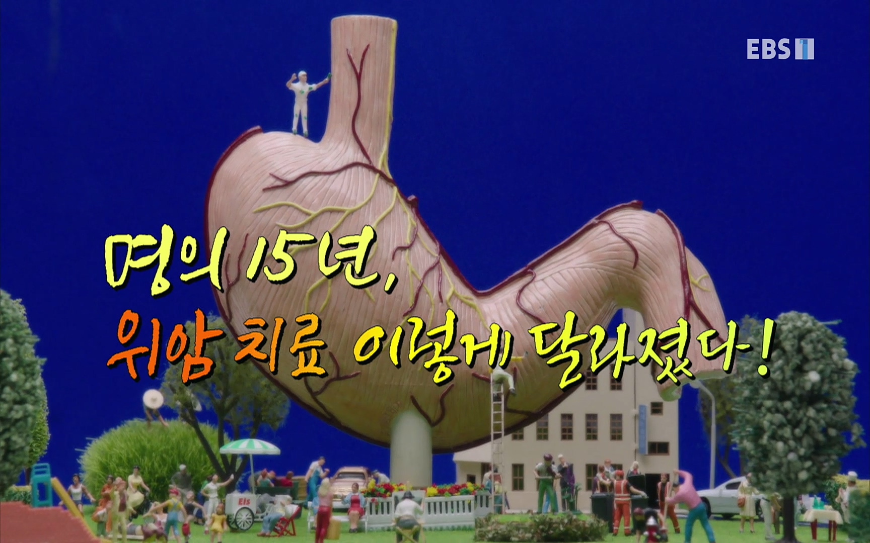 EBS 명의 헬스케어 - TV - 교육의 중심 EBS명의 15년, 위암 치료 이렇게 달라졌다!.mp4_20220809_201848.952.jpg