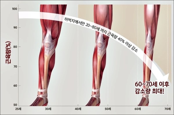  근육감소는 질병이며, 칼슘섭취와 운동으로 극복 가능