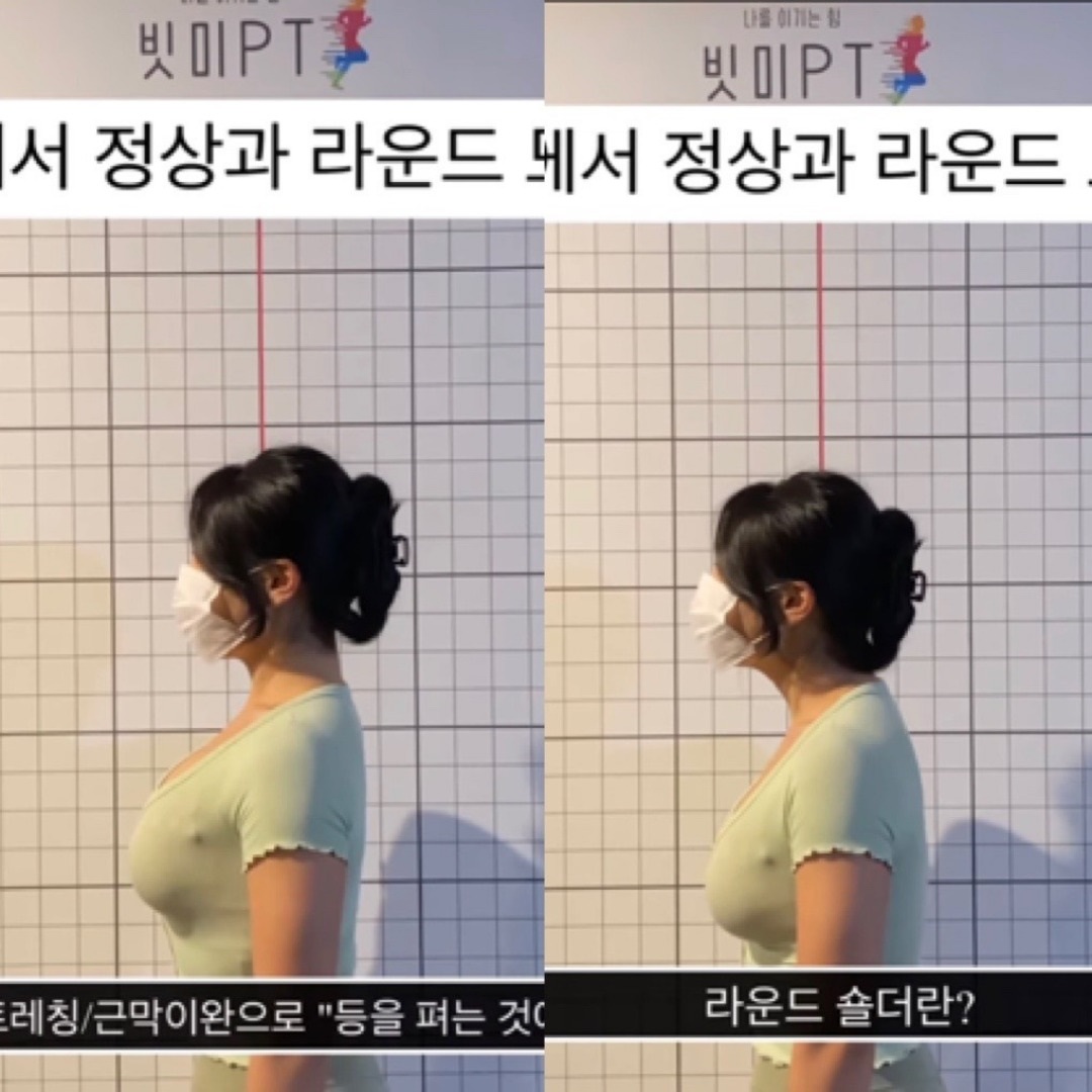  승모근 없애는 운동 홍대PT, 합정PT, 서교동PT :D[빗미PT]
