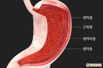 속쓰림 원인 증상 치료하는 방법_21