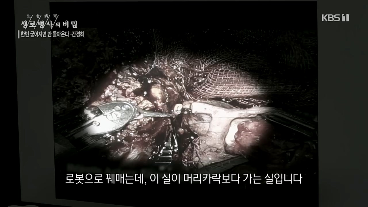 생로병사의 비밀.E863.230406p.H264-F1RST.mp4_20230406_202725.885.jpg