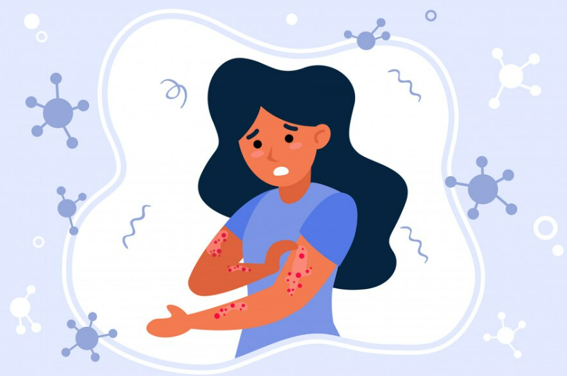 피부묘기증 기본정보&#44; 피부묘기증