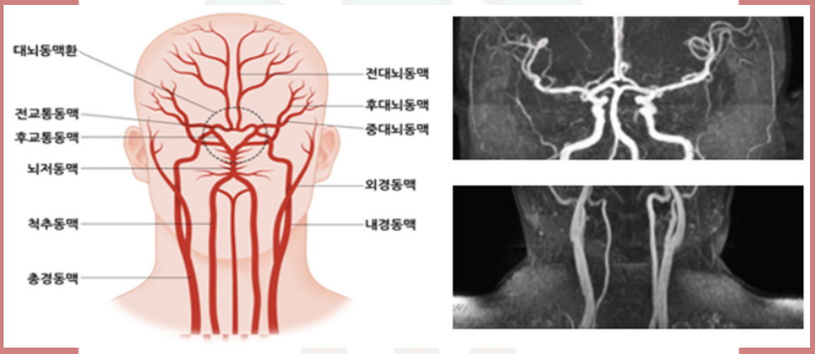 뇌혈관구조