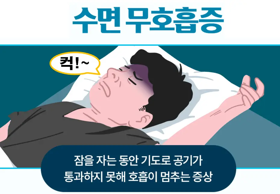 수면무호흡증