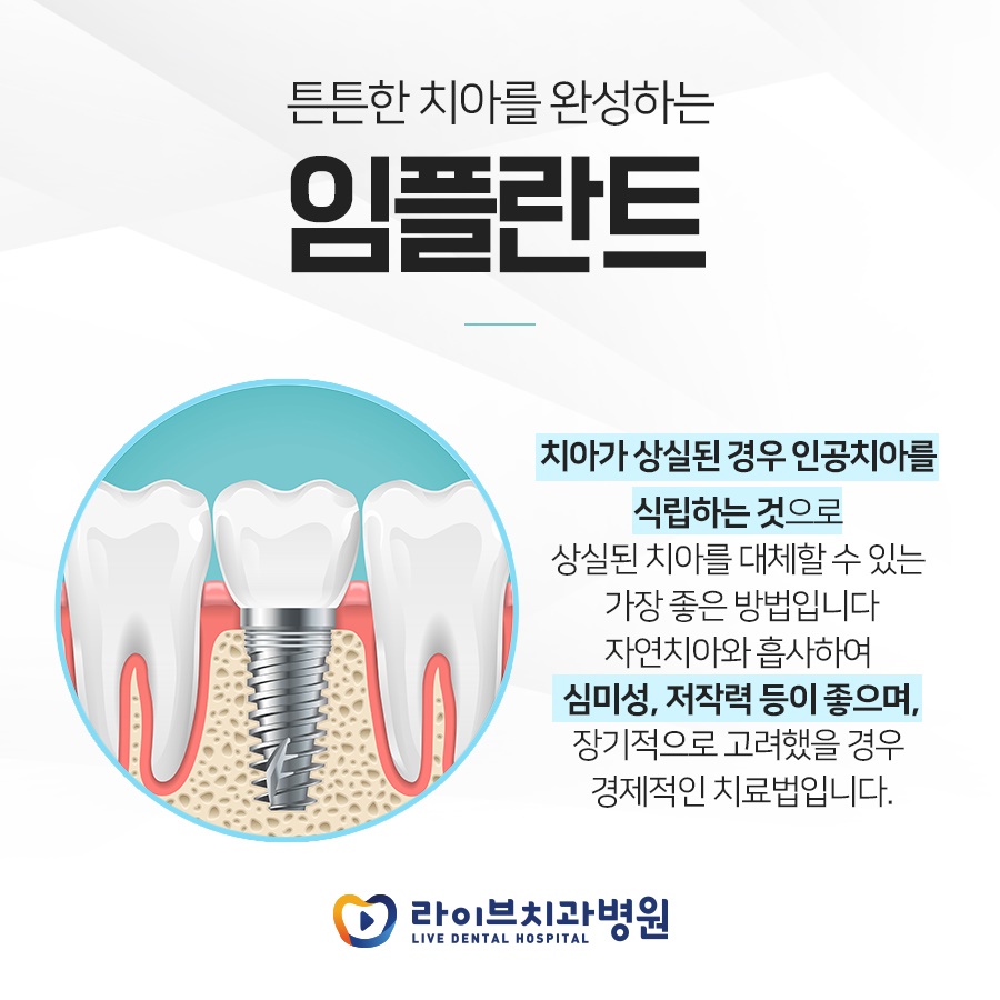 임플란트란 치아가 상실된 경우 인공치아를 식립하는 것