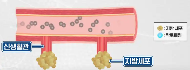 신생혈관에 붙은 지방세포