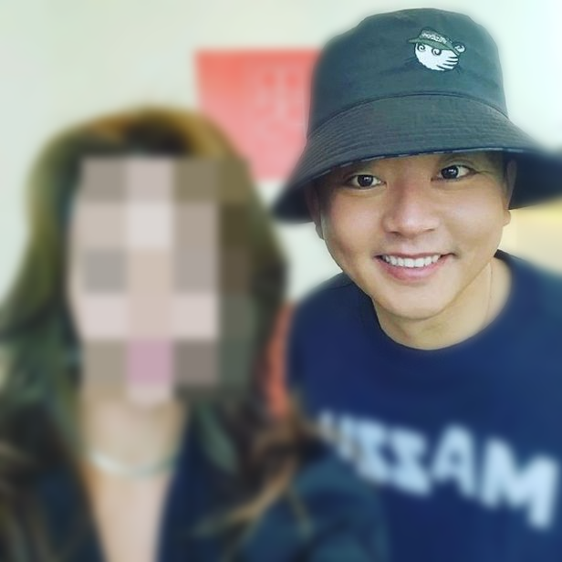  눈썹하거상술 성형 시술 훈남 김준호, 동안 눈 만들 수 있을까?
