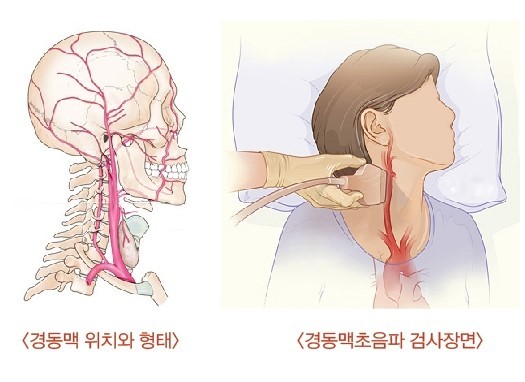 경동맥-위치