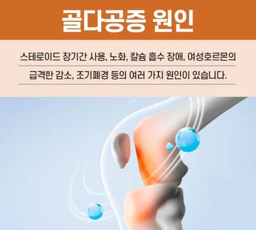 골다공증 원인