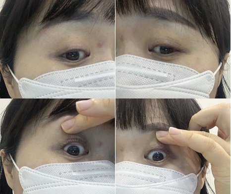 아이라인반영구 7