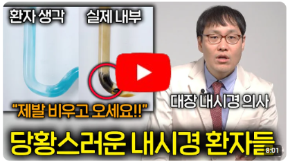 대장 내시경 의사를 환장하게 만드는 꽉찬 환자들