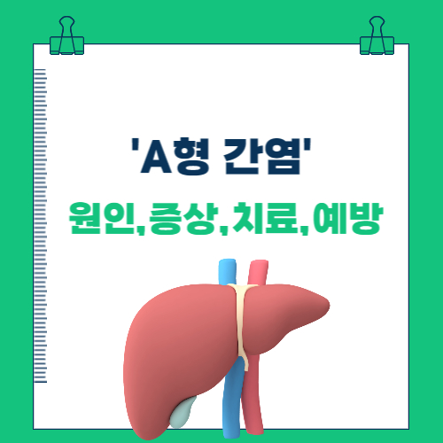  A형 간염의 원인, 증상, 치료 및 예방법