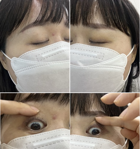 아이라인반영구 10