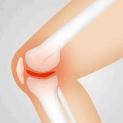  제물포 뇌전증응급처치 정리했습니다