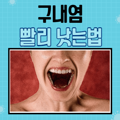 구내염 빨리 낫는법