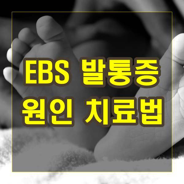 846회 EBS '명의'에서 발통증, 무지외반증, 말초신경병증, 발목 염좌 등 발 건강