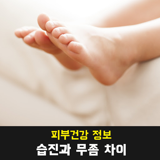  무좀과 습진
