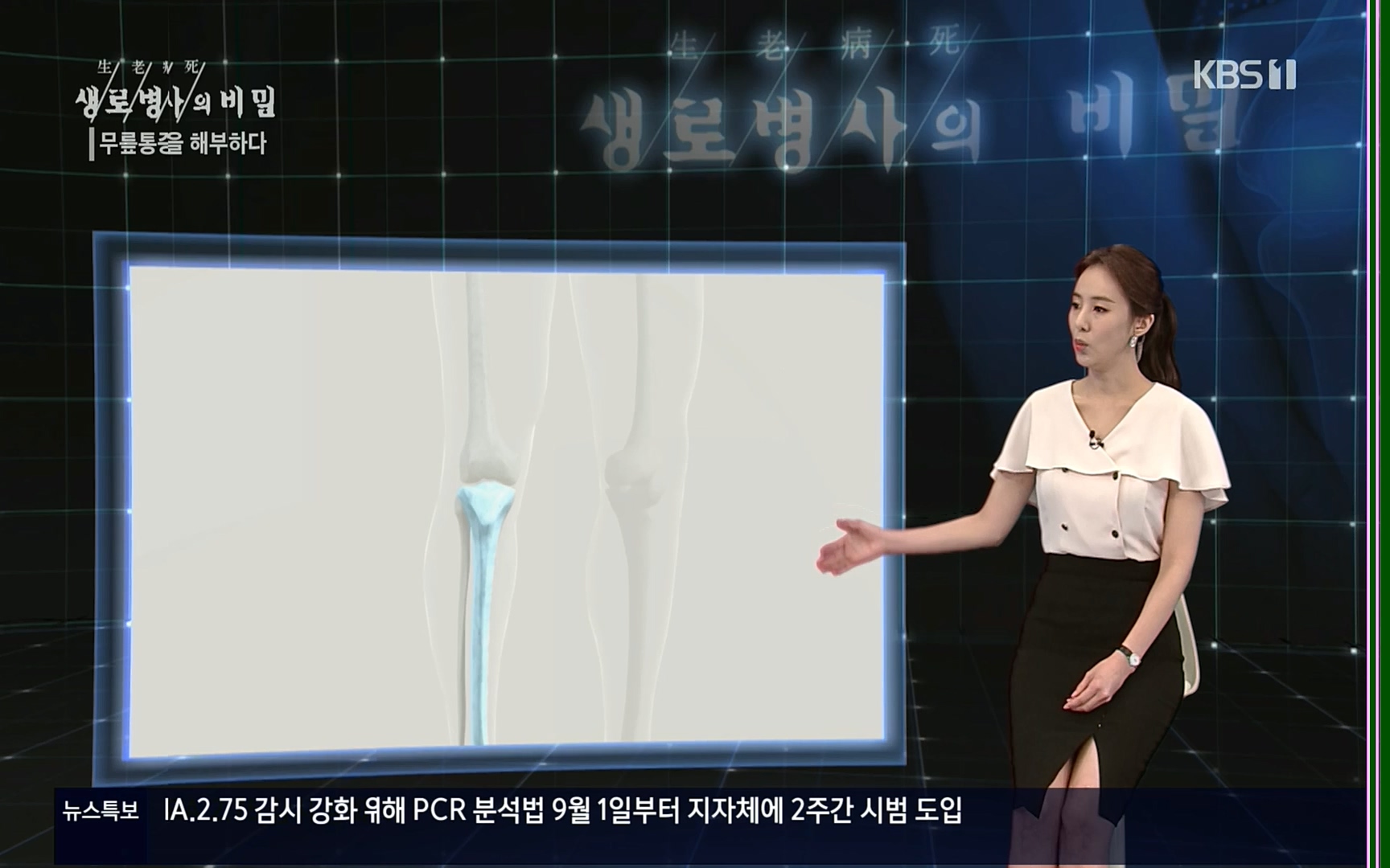 생로병사의 비밀.E834.220907p.H264-F1RST.mp4_20220908_210421.356.jpg