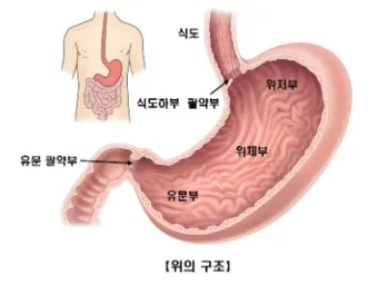 위염초기증상 역류성 식도염 차이점_3