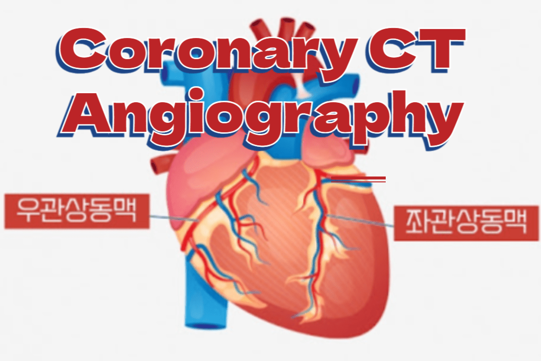 Coronary CT Angiography