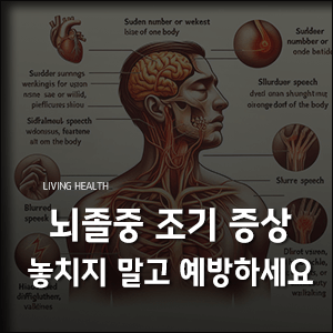 뇌졸중 조기 증상 놓치지 말고 예방하세요