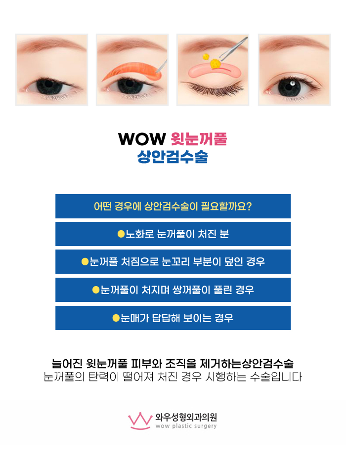 아름다운차이 이미지