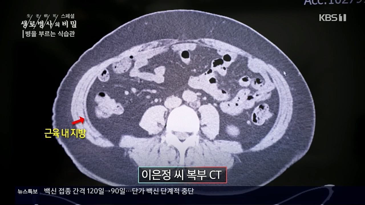 생로병사의 비밀.E844.221124p.H264-F1RST.mp4_20221124_201104.257.jpg