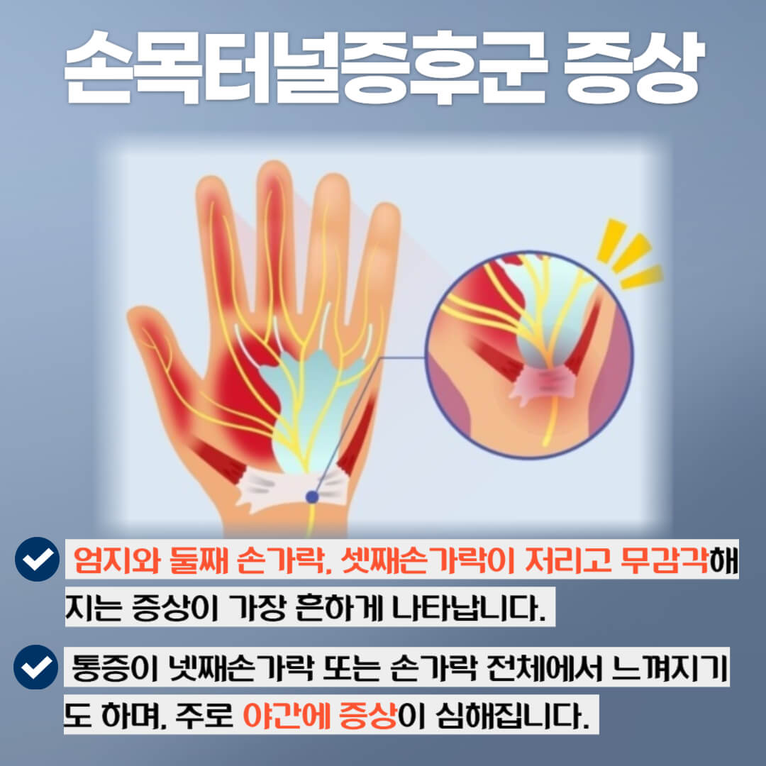 손목터널증후군의 증상
