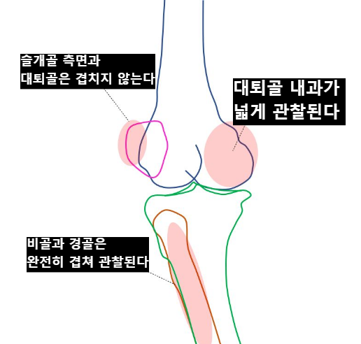 주의사항