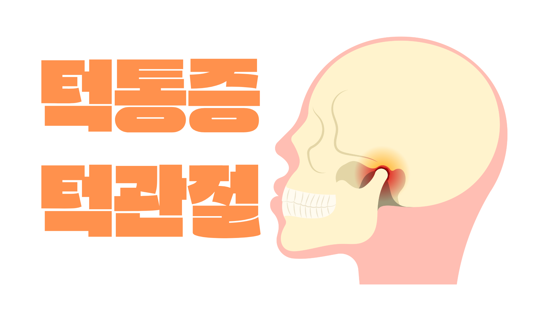 턱통증과 턱관절 장애