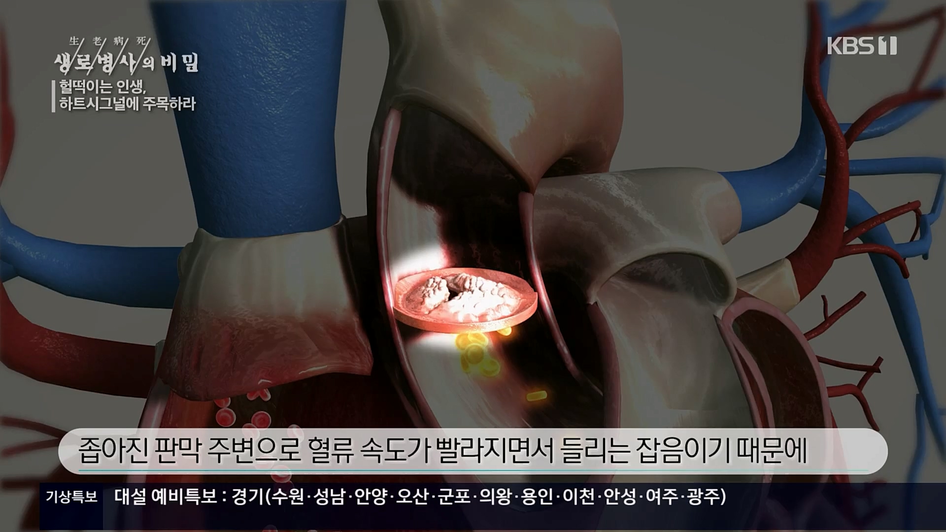 생로병사의 비밀.E853.230125p.H264-F1RST.mp4_20230210_203710.528.jpg