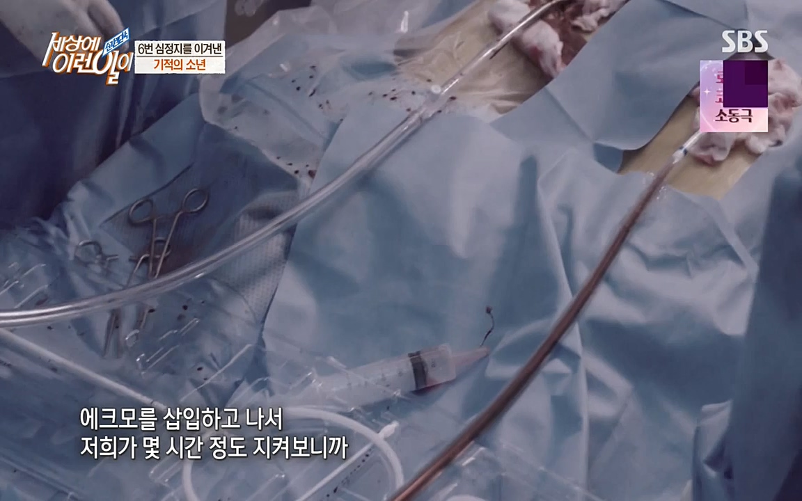 순간포착 세상에 이런일이.E1179.220511p-NEXT.mp4_20220511_175833.650.jpg