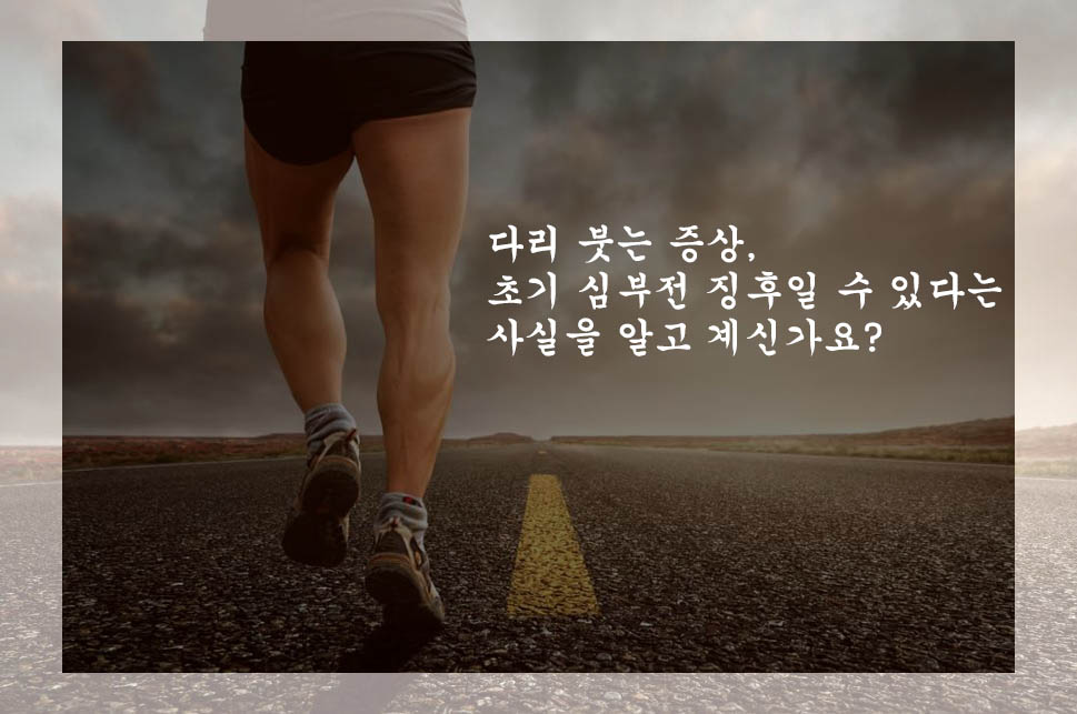  다리 붓는 증상, 초기 심부전 징후일 수 있다는 사실을 알고 계신가요?