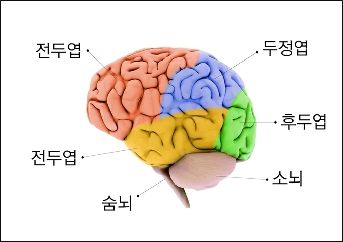 뇌경색 초기증상