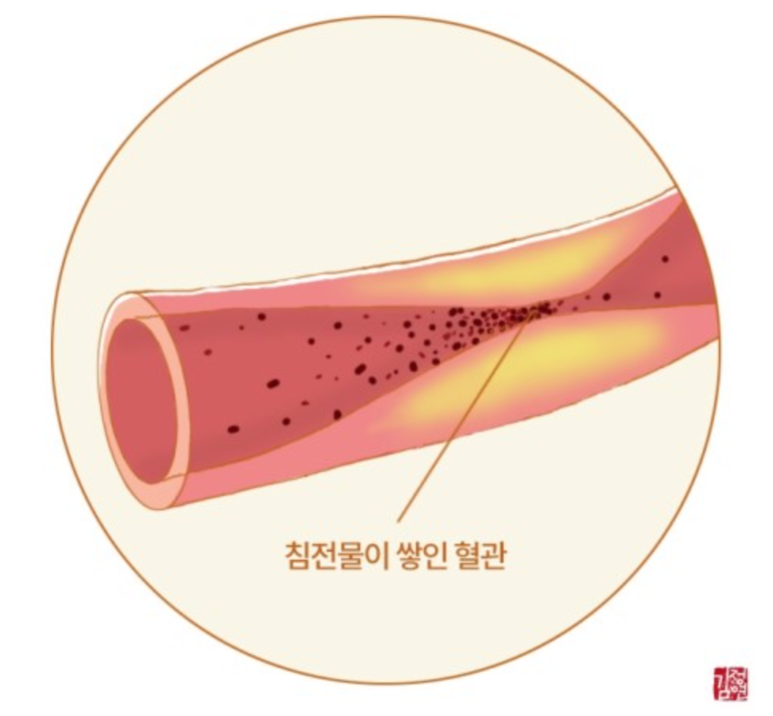 차이)알티지 rTG 오메가3, LDL HDL 트리글리세라이드 단비약사/고지혈증에도 종류가 있습니다 (콜레스테롤과 중성지방의