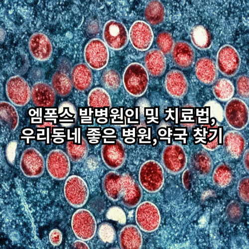 엠폭스-발병원인-치료법