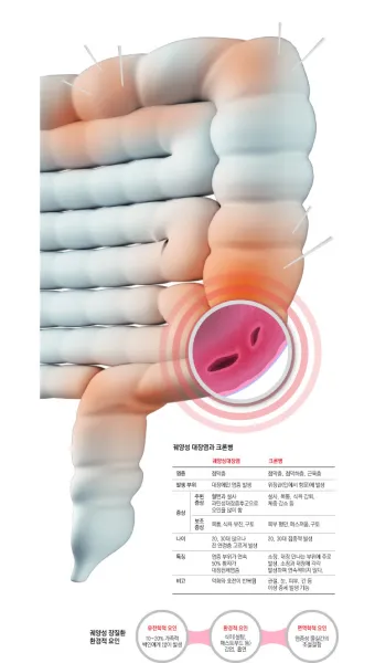 배가 부글부글 설사 원인파악 대처법_9