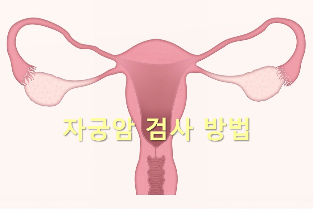 자궁경부암과 자궁체부암을 진단하는 자궁암 검사 방법
