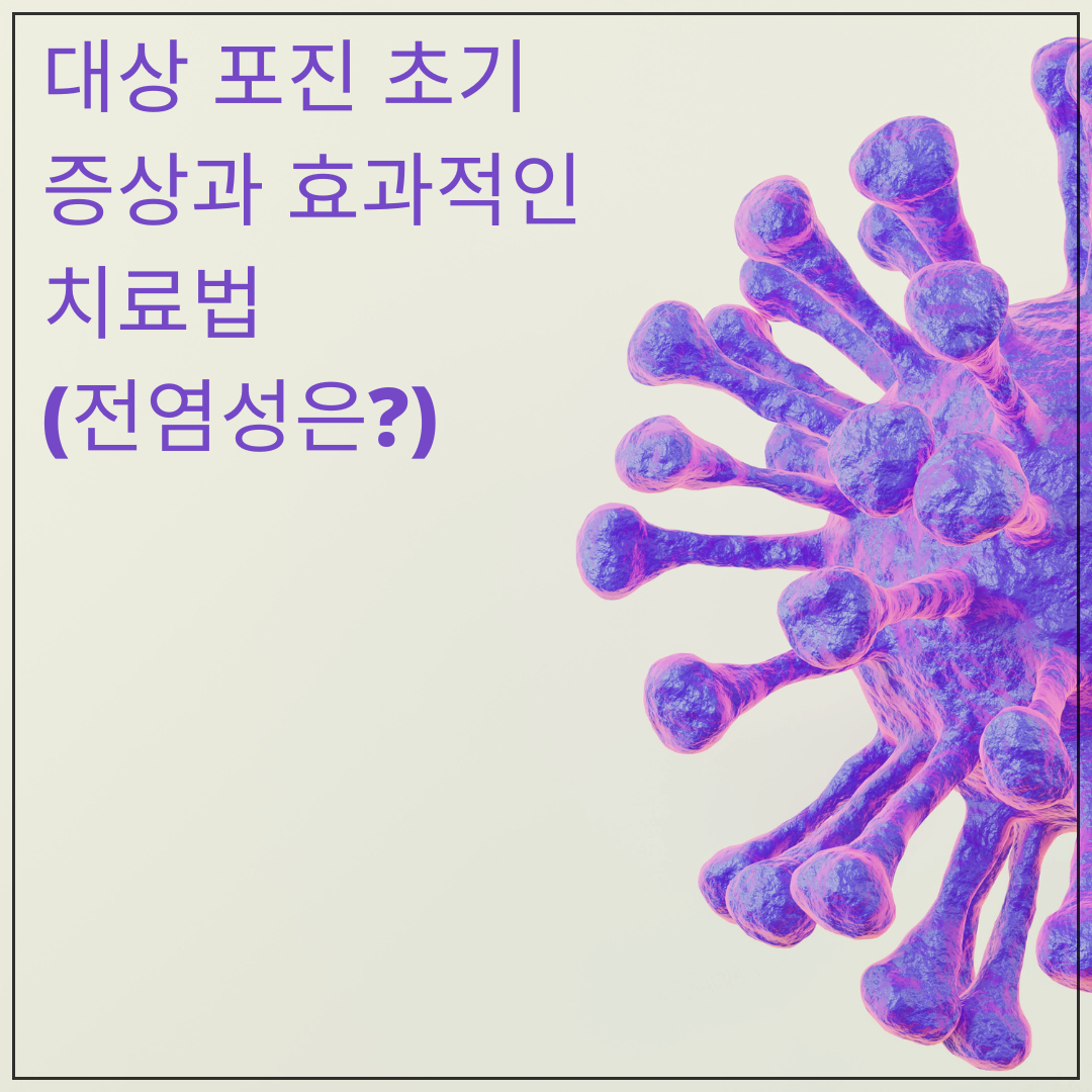 대상포진초기증상