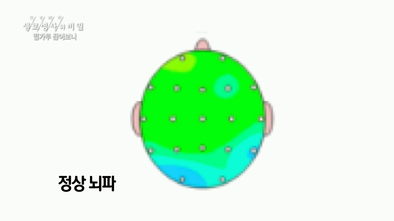 생로병사의 비밀.E846.221208p.H264-F1RST.mp4_20221210_182352.560.jpg