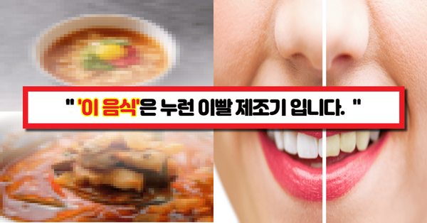  "이런 음식 절대 먹지 마세요" 돈과 시간을 들인 하얀 치아가 '이 음식' 한 번 먹고 누렇게 됩니다.