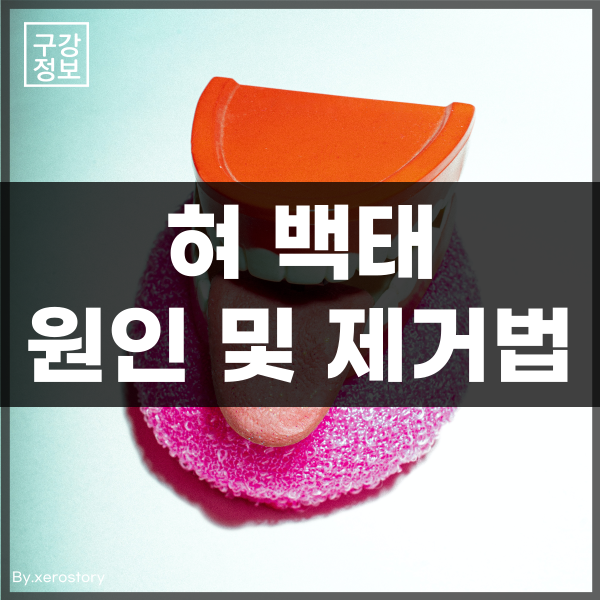  입냄새의 큰 요인, 혀 백태 원인과 제거방법