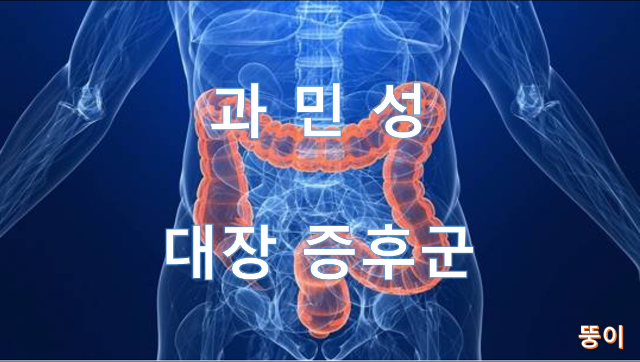  [일반 상식] 현대인의 90%가 걸리는 질병, 과민성대장증후군! 당신은 안녕하십니까?