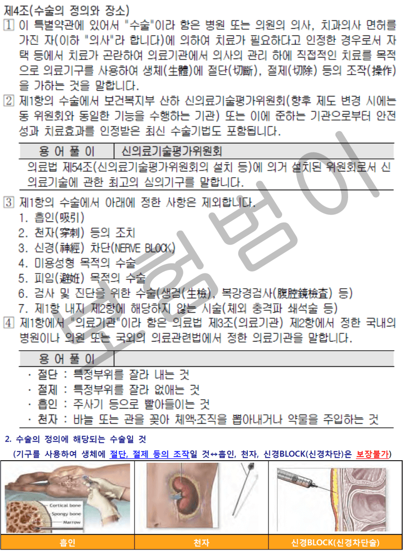 수술비 약관이 깔끔한 약관
